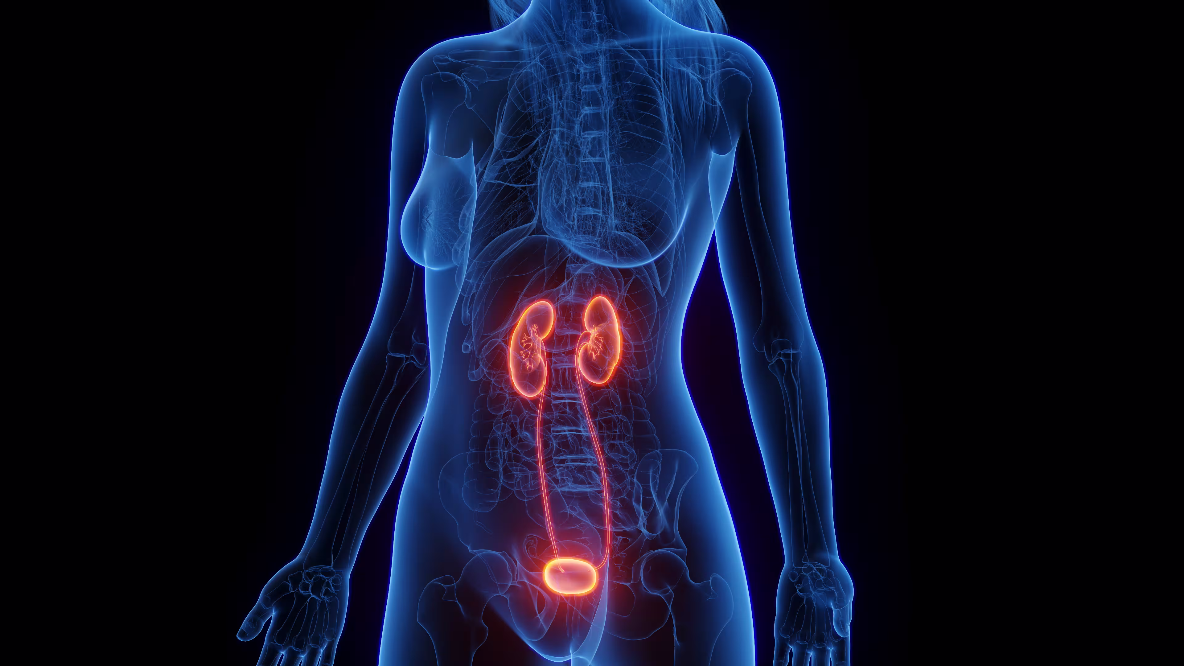 Internal Cystitis